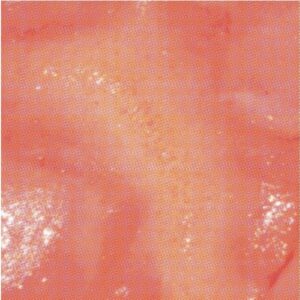 KLÄMP - Hate You (LP) (Limited Edition) (Coloured Vinyl)